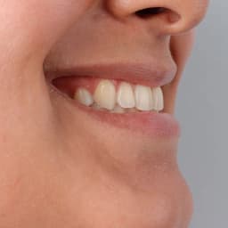 Dental image reference #5