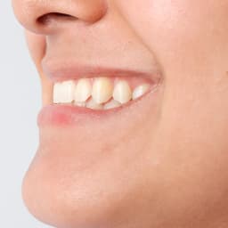 Dental image reference #4