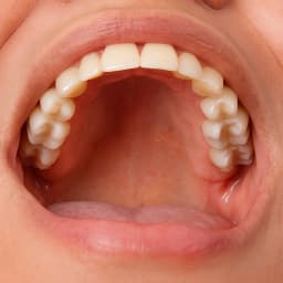 Dental image reference #1